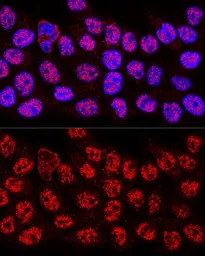 Anti-hnRNP A2B1 antibody used in Immunocytochemistry/ Immunofluorescence (ICC/IF). GTX32657