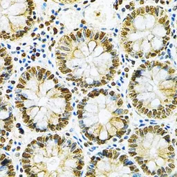 Anti-hnRNP A2B1 antibody used in IHC (Paraffin sections) (IHC-P). GTX32657