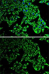 Anti-HSP60 antibody used in Immunocytochemistry/ Immunofluorescence (ICC/IF). GTX32661