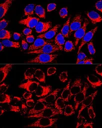 Anti-HSP60 antibody used in Immunocytochemistry/ Immunofluorescence (ICC/IF). GTX32661