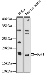 Anti-IGF1 antibody used in Western Blot (WB). GTX32670