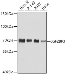 Anti-IMP3 antibody used in Western Blot (WB). GTX32680