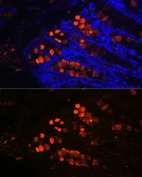 Anti-ITLN1 antibody used in IHC (Paraffin sections) (IHC-P). GTX32687