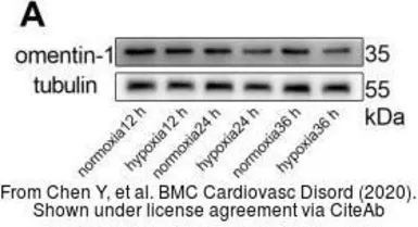 Anti-ITLN1 antibody used in Western Blot (WB). GTX32687