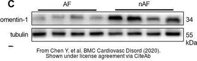 Anti-ITLN1 antibody used in Western Blot (WB). GTX32687