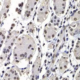 Anti-Macro H2A.1 antibody used in IHC (Paraffin sections) (IHC-P). GTX32709