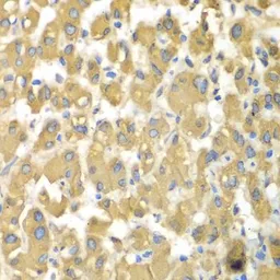 Anti-MAP4K3 antibody used in IHC (Paraffin sections) (IHC-P). GTX32713