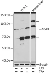 Anti-MSR1 antibody used in Western Blot (WB). GTX32729