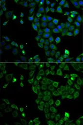 Anti-MSR1 antibody used in Immunocytochemistry/ Immunofluorescence (ICC/IF). GTX32729
