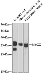 Anti-MYOZ2 antibody used in Western Blot (WB). GTX32734