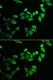 Anti-MYOZ2 antibody used in Immunocytochemistry/ Immunofluorescence (ICC/IF). GTX32734