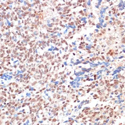 Anti-NAT5 antibody used in IHC (Paraffin sections) (IHC-P). GTX32736