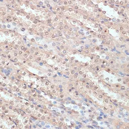 Anti-NAT5 antibody used in IHC (Paraffin sections) (IHC-P). GTX32736