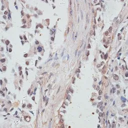 Anti-NCOA4 antibody used in IHC (Paraffin sections) (IHC-P). GTX32739