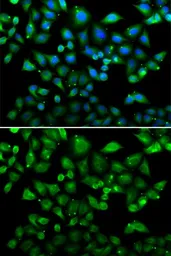 Anti-NHLRC1 antibody used in Immunocytochemistry/ Immunofluorescence (ICC/IF). GTX32750