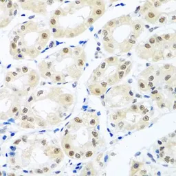 Anti-Nuclear Matrix Protein p84 antibody used in IHC (Paraffin sections) (IHC-P). GTX32757