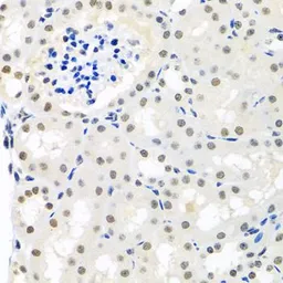 Anti-Nuclear Matrix Protein p84 antibody used in IHC (Paraffin sections) (IHC-P). GTX32757