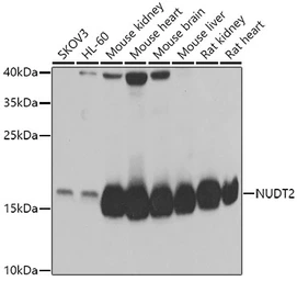 Anti-NUDT2 antibody used in Western Blot (WB). GTX32760