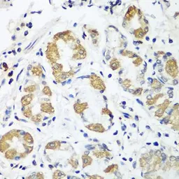 Anti-OXCT1 antibody used in IHC (Paraffin sections) (IHC-P). GTX32770