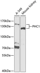 Anti-PHC1 antibody used in Western Blot (WB). GTX32784
