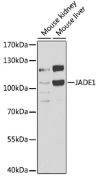 Anti-PHF17 antibody used in Western Blot (WB). GTX32786