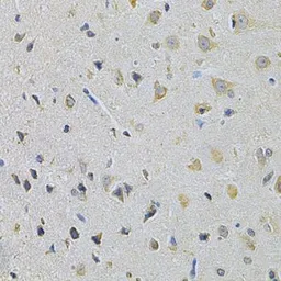 Anti-PPA1 antibody used in IHC (Paraffin sections) (IHC-P). GTX32802