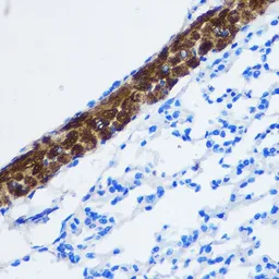 Anti-PPP1CB antibody used in IHC (Paraffin sections) (IHC-P). GTX32804