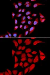 Anti-PSMA6 antibody used in Immunocytochemistry/ Immunofluorescence (ICC/IF). GTX32815