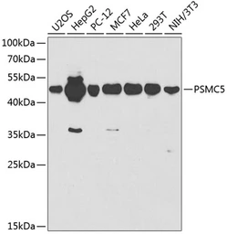 Anti-PSMC5 antibody used in Western Blot (WB). GTX32819