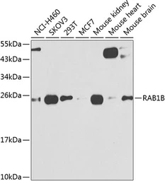 Anti-RAB1B antibody used in Western Blot (WB). GTX32825