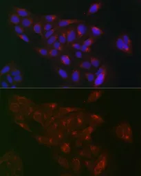 Anti-RAB1B antibody used in Immunocytochemistry/ Immunofluorescence (ICC/IF). GTX32825