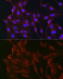Anti-RAB1B antibody used in Immunocytochemistry/ Immunofluorescence (ICC/IF). GTX32825
