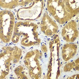 Anti-RAB1B antibody used in IHC (Paraffin sections) (IHC-P). GTX32825