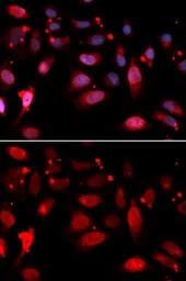 Anti-RACGAP1 antibody used in Immunocytochemistry/ Immunofluorescence (ICC/IF). GTX32831