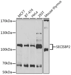 Anti-SBP2 antibody used in Western Blot (WB). GTX32857