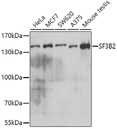 Anti-SF3B2 antibody used in Western Blot (WB). GTX32869