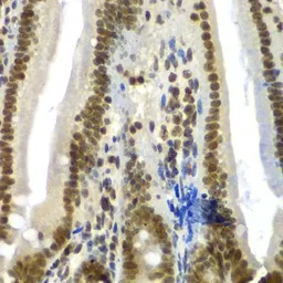Anti-SF3B2 antibody used in IHC (Paraffin sections) (IHC-P). GTX32869