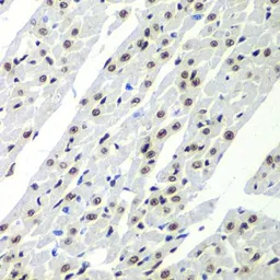 Anti-SF3B2 antibody used in IHC (Paraffin sections) (IHC-P). GTX32869