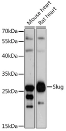Anti-SLUG antibody used in Western Blot (WB). GTX32879