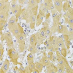 Anti-SLUG antibody used in IHC (Paraffin sections) (IHC-P). GTX32879