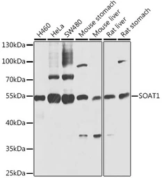 Anti-SOAT1 antibody used in Western Blot (WB). GTX32890