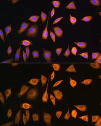 Anti-SOAT1 antibody used in Immunocytochemistry/ Immunofluorescence (ICC/IF). GTX32890
