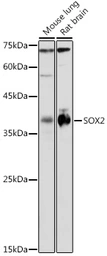 Anti-SOX2 antibody used in Western Blot (WB). GTX32891