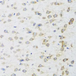 Anti-Striatin antibody used in IHC (Paraffin sections) (IHC-P). GTX32902
