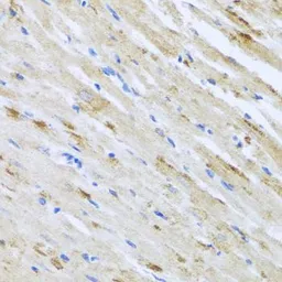 Anti-Striatin antibody used in IHC (Paraffin sections) (IHC-P). GTX32902