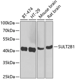 Anti-SULT2B1 antibody used in Western Blot (WB). GTX32904
