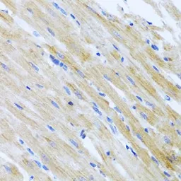 Anti-TARC antibody used in IHC (Paraffin sections) (IHC-P). GTX32911