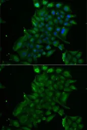 Anti-TCN1 antibody used in Immunocytochemistry/ Immunofluorescence (ICC/IF). GTX32915