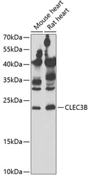 Anti-Tetranectin antibody used in Western Blot (WB). GTX32919