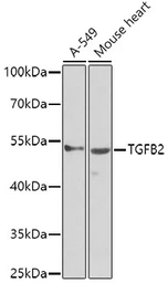 Anti-TGF beta 2 antibody used in Western Blot (WB). GTX32920